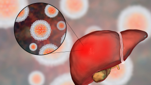 Representação gráfica de um fígado com hepatites virais